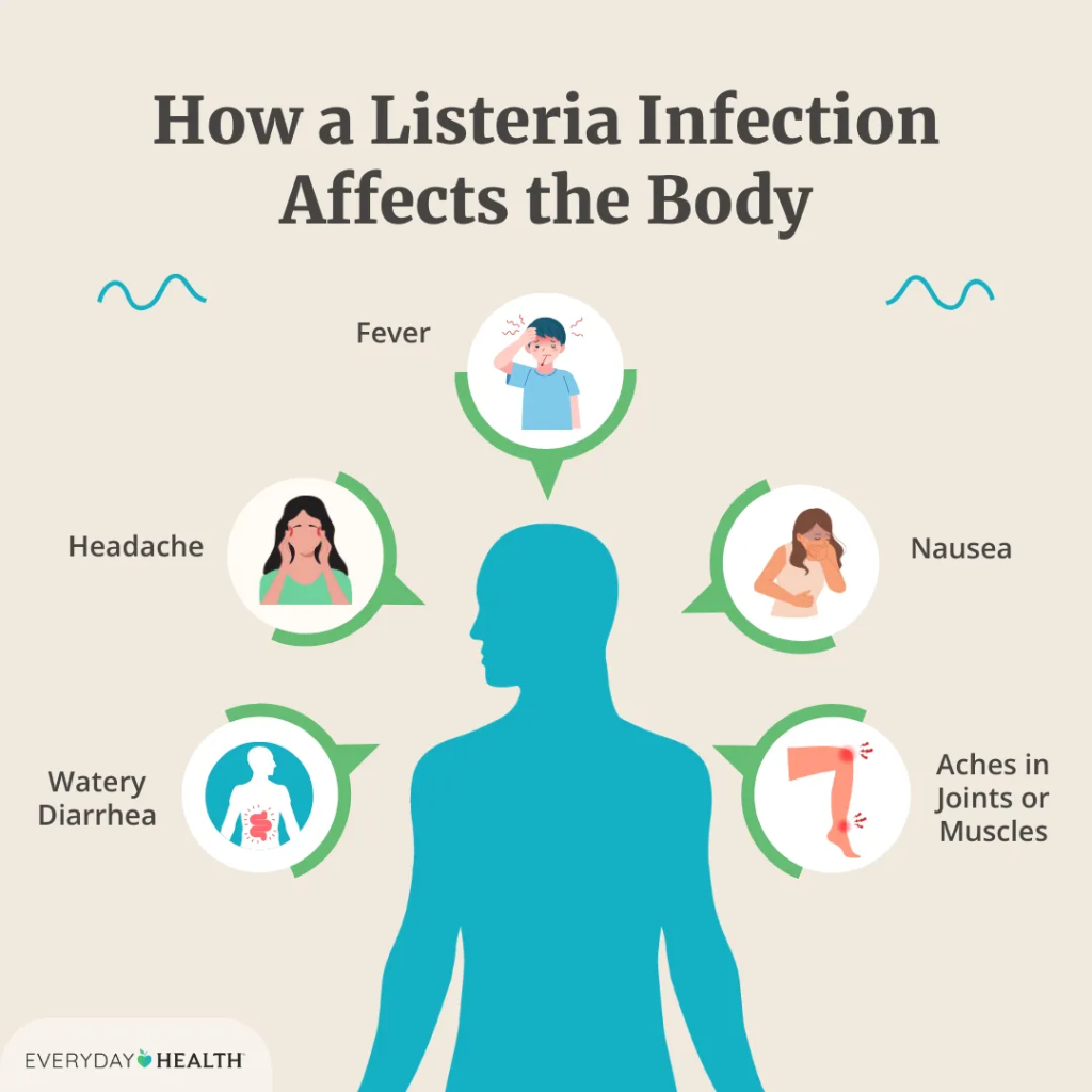 Everyday Health Source: Listeria Symptoms